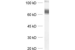 dilution: 1 : 1000, sample: synaptic membrane fraction (LP1) of rat brain