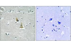 Immunohistochemistry analysis of paraffin-embedded human brain tissue, using p47 phox (Ab-345) Antibody. (NCF1 Antikörper  (AA 311-360))