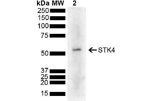 Western blot analysis of Human Cervical cancer cell line (HeLa) lysate showing detection of 55. (STK4 Antikörper  (AA 320-420) (HRP))
