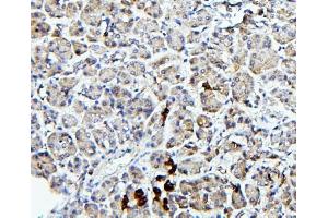 IHC analysis of TRPV5 using anti-TRPV5 antibody (ABIN7600034).
