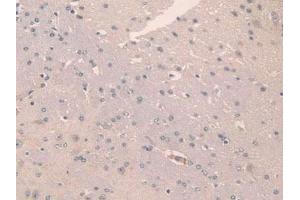 IHC-P analysis of Mouse Brain Tissue, with DAB staining. (SCGN Antikörper  (AA 1-276))