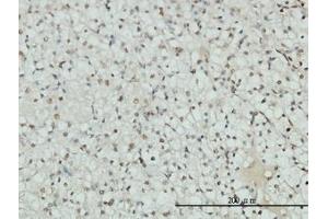 Image no. 1 for anti-Androgen Receptor (AR) (AA 221-321) antibody (ABIN598541) (Androgen Receptor Antikörper  (AA 221-321))