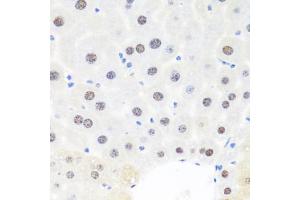 Immunohistochemistry (IHC) image for anti-Breast Cancer Metastasis Suppressor 1 (BRMS1) (AA 90-210) antibody (ABIN7265929)