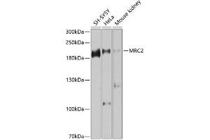 Western blot analysis of extracts of various cell lines, using MRC2 antibody (ABIN6129049, ABIN6143990, ABIN6143991 and ABIN6225189) at 1:1000 dilution. (MRC2 Antikörper  (AA 120-300))