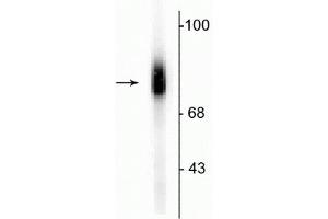Western blot of human adrenal medulla lysate showing specific immunolabeling of the ~75 kDa DBH protein. (DBH Antikörper  (C-Term))