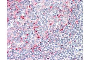 Immunohistochemistry (IHC) image for anti-Leukocyte Immunoglobulin-Like Receptor, Subfamily B (With TM and ITIM Domains), Member 2 (LILRB2) (C-Term) antibody (ABIN1909857)