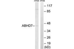 Western blot analysis of extracts from HT-29 cells, using ABHD7 Antibody. (EPHX4 Antikörper  (AA 101-150))