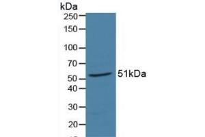 Retinoic Acid Receptor alpha Antikörper  (AA 68-173)