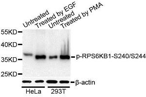Western blot analysis of extracts of various cell lines, using Phospho-RPS6KB1-S240/244 antibody. (RPS6 Antikörper  (pSer240, pSer244))