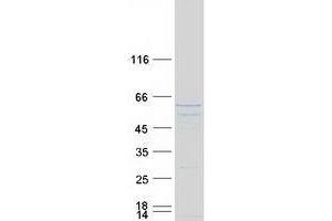 Western Blotting (WB) image for Tumor Suppressing Subtransferable Candidate 1 (TSSC1) protein (Myc-DYKDDDDK Tag) (ABIN2734458)