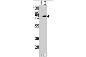 Western blot analysis of PRKCD (arrow) using rabbit PRKCD polyclonal antibody . (PKC delta Antikörper  (N-Term))