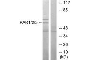 Western blot analysis of extracts from NIH-3T3 cells, using PAK1/2/3 (Ab-423/402/421) Antibody. (PAK1/2/3 Antikörper  (AA 391-440))