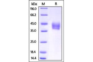 Mouse IL-4 R alpha, His Tag on SDS-PAGE under reducing (R) condition. (IL4 Receptor Protein (AA 26-233) (His tag))