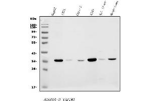 Western blot analysis of TMBIM1 using anti-TMBIM1 antibody (ABIN7603190).