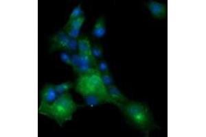 Image no. 2 for anti-Melan A (MLANA) antibody (ABIN1499425) (MLANA Antikörper)