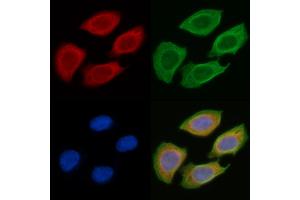 ABIN6256873 and ABIN6274321 staining Hela cells(45 min of heat-shock) by IF/ICC.