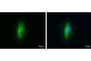 ICC/IF Image ARHGAP1 antibody [N1N3] detects ARHGAP1 protein at cytoplasm by immunofluorescent analysis. (ARHGAP1 Antikörper  (N-Term))