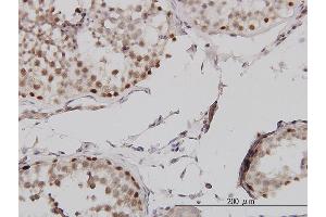 Immunoperoxidase of monoclonal antibody to MLH1 on formalin-fixed paraffin-embedded human testis.