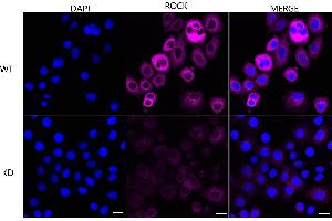 Immunocytochemical staining of HeLa cells using ROCK2 antibody (ABIN7800205), 1:1,000), Top panel: wild-type (WT), Bottom panal: ROCK2 shRNA knockdown (KD). (Rekombinanter ROCK2 Antikörper)