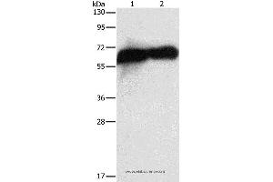 Western blot analysis of HepG2 cell and human placenta tissue, using ALPP Polyclonal Antibody at dilution of 1:1450 (PLAP Antikörper)