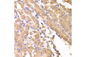 Immunohistochemistry of paraffin-embedded human stomach using SUFU antibody (ABIN5974087) at dilution of 1/100 (40x lens).
