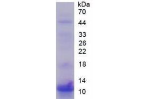 SDS-PAGE analysis of Human S100P Protein. (S100P Protein)