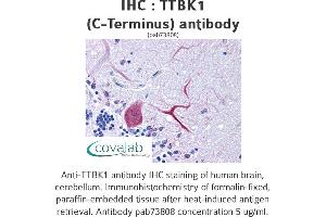 Image no. 1 for anti-tau Tubulin Kinase 1 (Ttbk1) (C-Term) antibody (ABIN1740433) (TTBK1 Antikörper  (C-Term))
