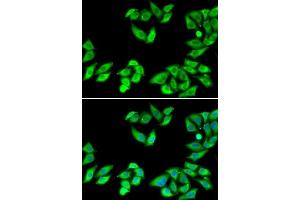Immunofluorescence analysis of MCF7 cells using RPS14 antibody. (RPS14 Antikörper  (AA 1-151))