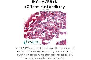 Image no. 1 for anti-Arginine Vasopressin Receptor 1B (AVPR1B) (C-Term) antibody (ABIN1732149) (AVPR1B Antikörper  (C-Term))