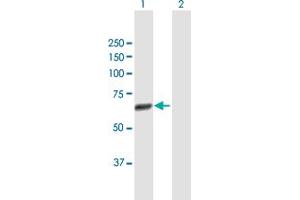 Western Blot analysis of CDC45L expression in transfected 293T cell line by CDC45L MaxPab polyclonal antibody. (CDC45 Antikörper  (AA 1-566))