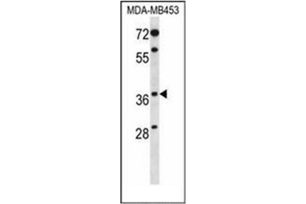 PAQR8 抗体  (C-Term)
