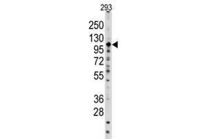 Image no. 1 for anti-Sal-Like 4 (SALL4) (C-Term) antibody (ABIN357018) (SALL4 Antikörper  (C-Term))