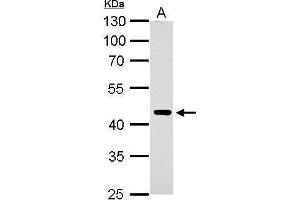 ERCC8 Antikörper  (Center)