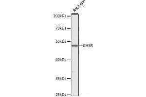 Western blot analysis of extracts of Rat brain using GHSR Polyclonal Antibody at dilution of 1:1000. (GHSR Antikörper)