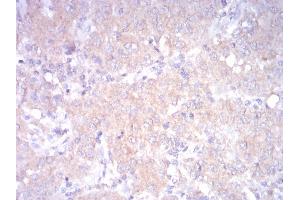 Immunohistochemistry (IHC) image for anti-Low Density Lipoprotein Receptor (LDLR) (AA 22-150) antibody (ABIN5542334)