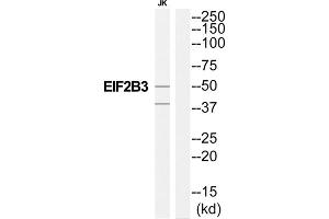 Western Blotting (WB) image for anti-Eukaryotic Translation Initiation Factor 2B, Subunit 3 Gamma, 58kDa (EIF2B3) (Internal Region) antibody (ABIN1852310) (EIF2B3 Antikörper  (Internal Region))