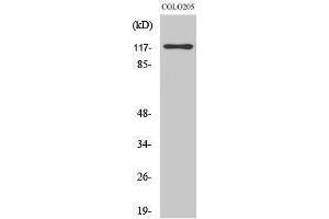 Western Blotting (WB) image for anti-DNA-Damage-Inducible Transcript 3 (DDIT3) (N-Term) antibody (ABIN3183583) (DDIT3 Antikörper  (N-Term))