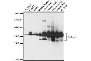 Western blot analysis of extracts of various cell lines, using SUCLG1 antibody. (SUCLG1 Antikörper)