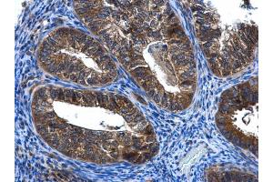Immunohistochemistry (IHC) image for anti-FYVE, RhoGEF and PH Domain Containing 4 (FGD4) antibody (ABIN2856709)