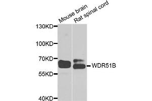 Western blot analysis of extracts of various cell lines, using POC1B antibody (ABIN5974757) at 1/1000 dilution. (POC1B Antikörper)