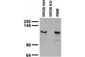 Immunoblot against rat brain membranes (RBM) and neuronal lysates from NR2B knockout (KO) and heterozygote (Het) mice.