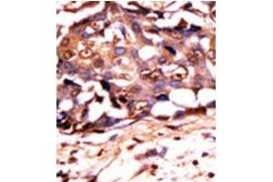 Image no. 1 for anti-Signal Transducer and Activator of Transcription 3 (Acute-Phase Response Factor) (STAT3) (pTyr705) antibody (ABIN358234) (STAT3 Antikörper  (pTyr705))
