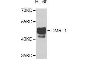 Western blot analysis of extracts of HL-60 cells, using DMRT1 antibody. (DMRT1 Antikörper)