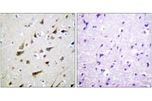 Immunohistochemistry analysis of paraffin-embedded human brain tissue, using Calsenilin/KCNIP3 (Ab-63) Antibody.