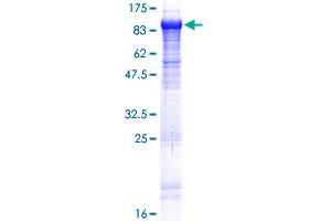 Image no. 1 for Kelch-Like 22 (KLHL22) (AA 1-634) protein (GST tag) (ABIN1308809)