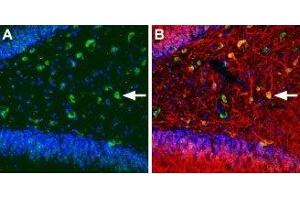 Expression of KCNQ5 in rat hippocampus - Immunohistochemical staining of immersion-fixed, free floating rat brain frozen sections using Anti-KCNQ5 Antibody (ABIN7043507, ABIN7045050 and ABIN7045051), (1:100).