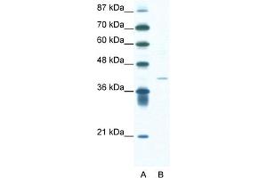 WB Suggested Anti-HIF1AN Antibody Titration:  1. (HIF1AN Antikörper  (N-Term))