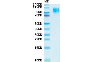 PDGFRB Protein (AA 33-530) (His-Avi Tag)