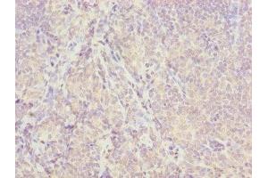 Immunohistochemistry of paraffin-embedded human tonsil tissue using ABIN7157054 at dilution of 1:100 (ISCA2 Antikörper  (AA 9-154))