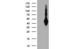 Western Blotting (WB) image for anti-SH2 Domain Protein 2A (SH2D2A) antibody (ABIN1500913)